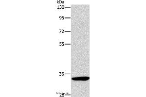 Western blot analysis of Mouse kidney tissue, using NCR1 Polyclonal Antibody at dilution of 1:450 (NCR1 anticorps)