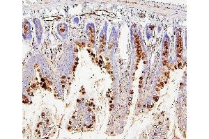 IHC analysis of RAB27A using anti-RAB27A antibody (ABIN7602714). (RAB27A anticorps  (AA 98-216))