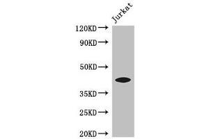 Western Blot Positive WB detected in: Jurkat whole cell lysate All lanes: FOXQ1 antibody at 3 μg/mL Secondary Goat polyclonal to rabbit IgG at 1/50000 dilution Predicted band size: 42 kDa Observed band size: 42 kDa (FOXQ1 anticorps  (AA 10-123))