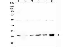 Western blot analysis of LRTOMT using anti-LRTOMT antibody (ABIN7602986). (Leucine Rich Transmembrane and 0-Methyltransferase Domain Containing (LRTOMT) (Middle Region) anticorps)