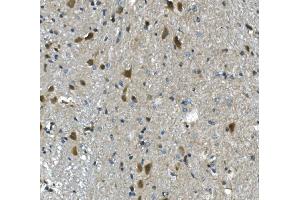 IHC analysis of PAR4/Pawr using anti-PAR4/Pawr antibody (ABIN7599938). (PAWR anticorps  (AA 13-333))