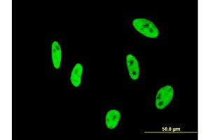 Immunofluorescence of monoclonal antibody to NUDT21 on HeLa cell.
