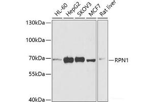 Western blot analysis of extracts of various cell lines using RPN1 Polyclonal Antibody at dilution of 1:1000. (RPN1 anticorps)