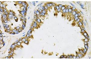 Immunohistochemistry of paraffin-embedded Human prostate using EFNA1 Polyclonal Antibody at dilution of 1:100 (40x lens).