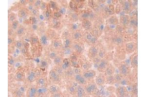 Detection of gp130 in Mouse Liver Tissue using Polyclonal Antibody to Glycoprotein 130 (gp130)
