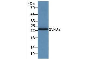Detection of Recombinant F2, Rat using Monoclonal Antibody to Coagulation Factor II (F2) (Prothrombin anticorps  (AA 44-200))