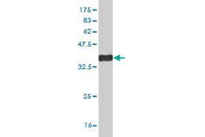 Western Blot detection against Immunogen (38. (DLX2 anticorps  (AA 1-110))