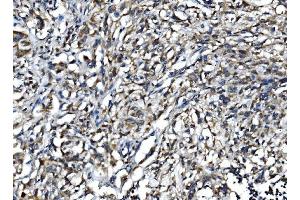 IHC analysis of IL15 using anti-IL15 antibody (ABIN7602347). (IL-15 anticorps  (AA 70-162))