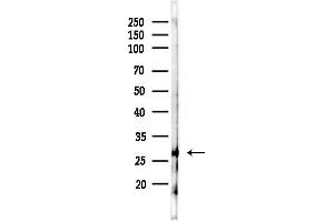 anti-Proteasome (Prosome, Macropain) 26S Subunit, Non-ATPase, 9 (PSMD9) (N-Term) antibody