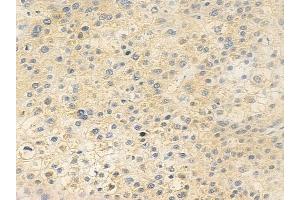 anti-Lipocalin 6 (LCN6) (Internal Region) antibody