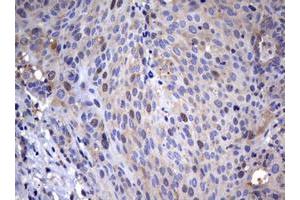 Image no. 2 for anti-Wingless-Type MMTV Integration Site Family, Member 3 (WNT3) (AA 128-355) antibody (ABIN1490900)