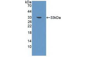 Western blot analysis of recombinant Human PIK3C3. (PIK3C3 anticorps  (AA 631-885))