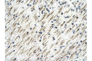 Rabbit Anti-SSBP2 antibody Catalog Number: ARP31828  Paraffin Embedded Tissue: Human Brain cell Cellular Data: Nerve fibre of renal tubule Antibody Concentration: 4.