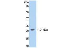 Detection of Recombinant GAS6, Mouse using Polyclonal Antibody to Growth Arrest Specific Protein 6 (GAS6) (GAS6 anticorps  (AA 483-646))