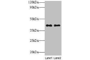 Western blot All lanes: QPCT antibody at 2 μg/mL Lane 1: Rat muscle tissue Lane 2: Rat adrenal gland tissue Secondary Goat polyclonal to rabbit IgG at 1/10000 dilution Predicted band size: 41, 36 kDa Observed band size: 41 kDa (QPCT anticorps  (AA 29-361))