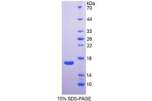 SDS-PAGE analysis of Rabbit AQP1 Protein. (Aquaporin 1 Protéine)