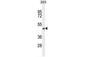 COCH Antibody (C-term) western blot analysis in 293 cell line lysates (35µg/lane). (COCH anticorps  (C-Term))