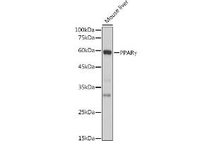 Western blot analysis of extracts of Mouse liver, using PPARγ antibody (ABIN6134090, ABIN6146004, ABIN6146006 and ABIN6215096) at 1:1000 dilution. (PPARG anticorps  (AA 70-170))