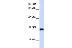 WB Suggested Anti-PEX11A Antibody Titration:  0. (PEX11A anticorps  (Middle Region))