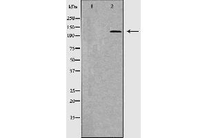 Western blot analysis of extracts of HepG2, using THBS1 antibody.
