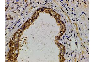 ABIN6277691 at 1/200 staining human myosarcoma tissue sections by IHC-P. (Ephrin B2 anticorps  (C-Term))