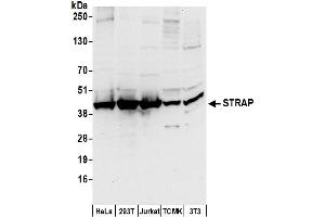 Western Blotting (WB) image for anti-Serine/threonine Kinase Receptor Associated Protein (STRAP) (AA 300-350) antibody (ABIN7450785)