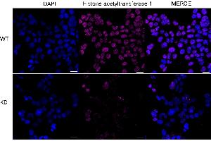 Immunocytochemical staining of HeLa cells using Histone acetyltransferase 1 antibody (ABIN7798921), 1:1,000), Top panel: wild-type (WT), Bottom panal:Histone acetyltransferase 1 shRNA knockdown (KD). (Recombinant HAT1 anticorps)