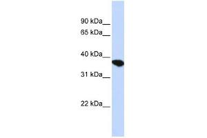 ST8SIA4 antibody used at 1 ug/ml to detect target protein. (ST8SIA4 anticorps  (Middle Region))