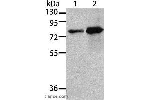Western blot analysis of 293T and A431 cell, using MSN Polyclonal Antibody at dilution of 1:500 (Moesin anticorps)