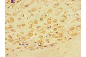 Immunohistochemistry of paraffin-embedded human placental tissue using ABIN7143102 at dilution of 1:100 (ACTR3 anticorps  (AA 352-409))