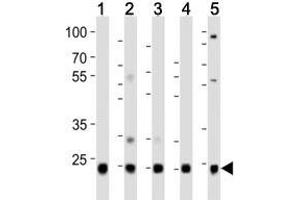 Western blot analysis of lysate from HeLa (1), HepG2 (2), Jurkat (3), mouse liver (4) , rat kidney  (5) lysate using UBB/ Ubiquitin antibody at 1:1000.