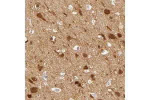 Immunohistochemical staining of human cerebral cortex with DLG3 polyclonal antibody  shows distinct nuclear and cytoplasmic positivity in neuronal cells at 1:50-1:200 dilution. (DLG3 anticorps)