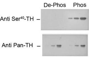 Image no. 1 for anti-Tyrosine Hydroxylase (TH) (pSer40) antibody (ABIN372738)