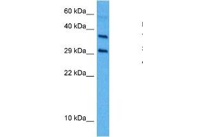 Host:  Mouse  Target Name:  TGFB1  Sample Tissue:  Mouse Spleen  Antibody Dilution:  1ug/ml
