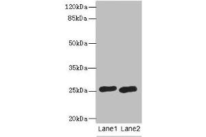 Western blot All lanes: RAB20 antibody at 0. (RAB2A anticorps  (AA 1-234))
