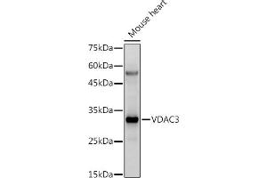 Western blot analysis of extracts of Mouse heart, using VD antibody (ABIN6130775, ABIN6150077, ABIN6150078 and ABIN6214830) at 1:500 dilution.