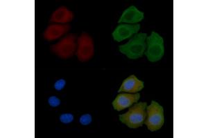ABIN7094200 and ABIN7098246 staining Hela cells(45 min of heat-shock) by IF/ICC.