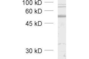 dilution: 1 : 1000, sample: unboiled synaptic membrane fraction of rat brain (LP1) (GABRB3 anticorps  (AA 344-429))