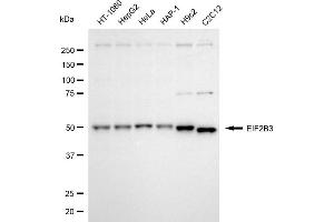 Western blotting analysis using EIF2B3 antibody (ABIN7798514).