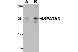 Western Blotting (WB) image for anti-Spermatogenesis Associated 3 (SPATA3) (C-Term) antibody (ABIN1077366) (SPATA3 anticorps  (C-Term))