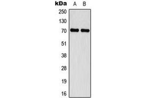 Western blot analysis of Merlin (pS518) expression in MCF7 IFN-treated (A), Jurkat IFN-treated (B) whole cell lysates.