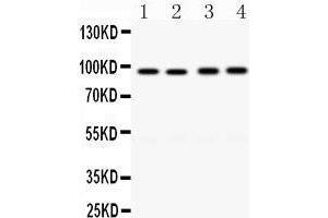 Western Blotting (WB) image for anti-CD19 Molecule (CD19) (AA 307-337), (Middle Region) antibody (ABIN3043389) (CD19 anticorps  (Middle Region))