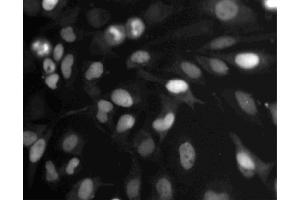 Immunofluorescent staining of HeLa cells. (Topo IIalpha (AA 1245-1361) anticorps)