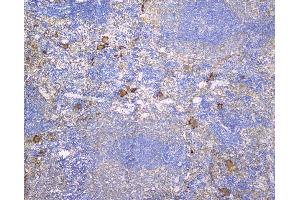 IHC analysis of CD229 using anti-CD229 antibody (ABIN6719290). (LY9 anticorps)