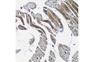 Immunohistochemistry of paraffin-embedded rat heart using Nesprin 1 Rabbit pAb (ABIN7270520) at dilution of 1:100 (40x lens). (SYNE1 anticorps)