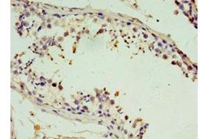Immunohistochemistry of paraffin-embedded human testis tissue using ABIN7171225 at dilution of 1:100 (Syntaxin 11 anticorps  (AA 1-287))