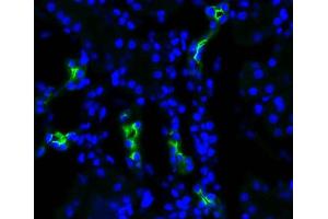Immunohistochemistry analysis using Rabbit Anti-Aquaporin 2 Polyclonal Antibody .