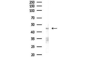 anti-Carcinoembryonic Antigen-Related Cell Adhesion Molecule 16 (CEACAM16) (Internal Region) antibody