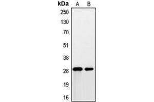Western blot analysis of PSCA expression in DU145 (A), human prostate (B) whole cell lysates.