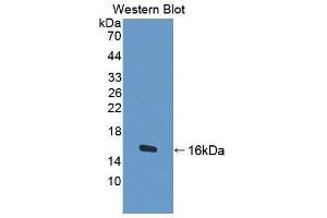Detection of Recombinant BCHE, Human using Polyclonal Antibody to Butyrylcholinesterase (BCHE) (Butyrylcholinesterase anticorps  (AA 29-150))